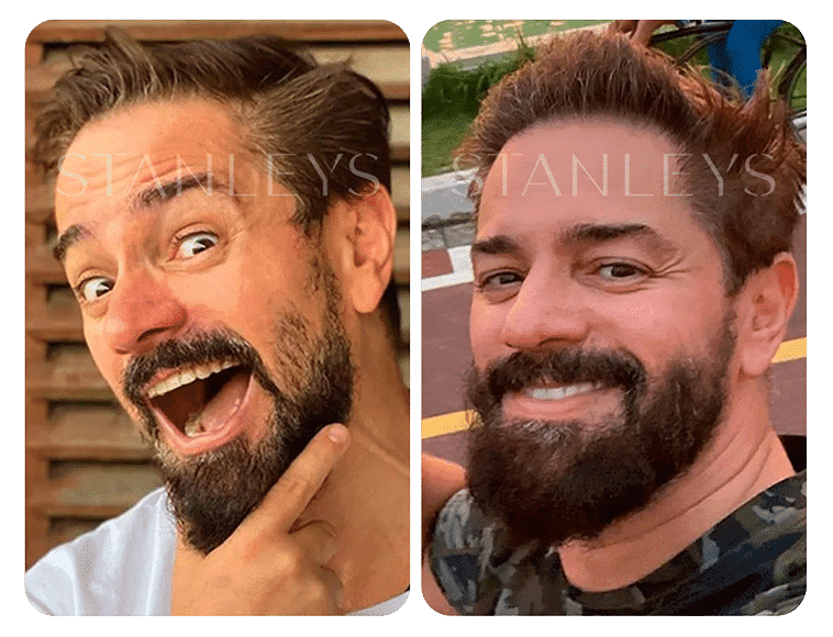 Antes e depois 2