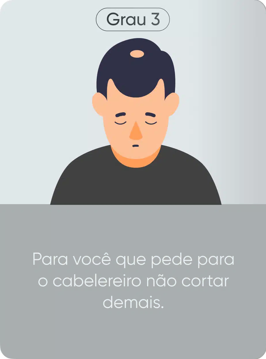 Grau de calvície 3