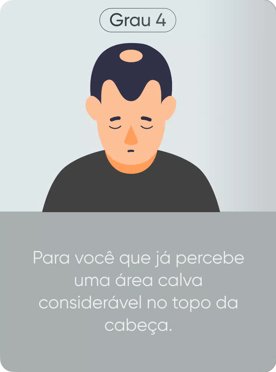 Grau de calvície 4