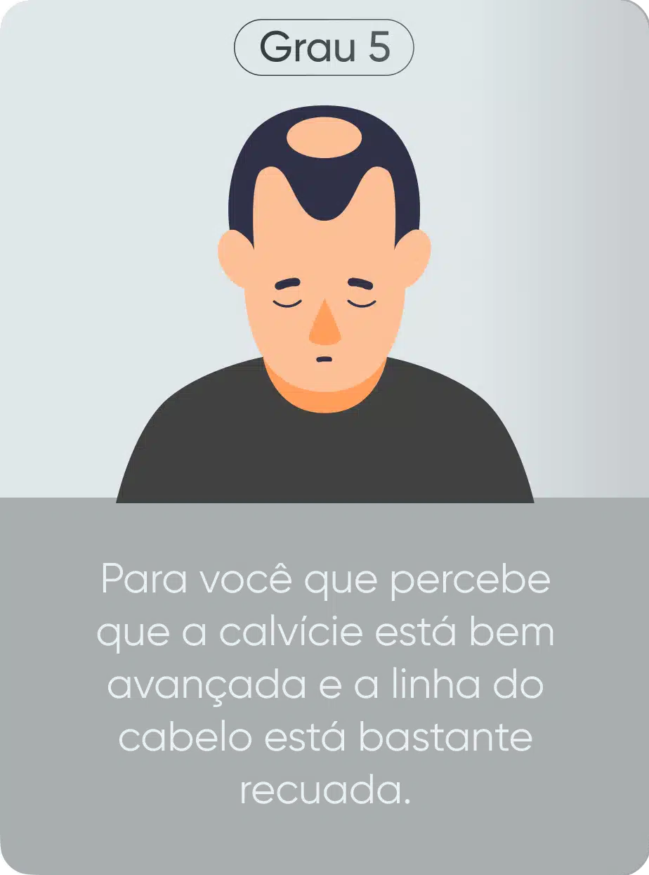 Grau de calvície 5