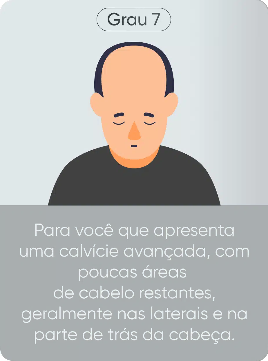 Grau de calvície 7